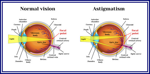 eye problem