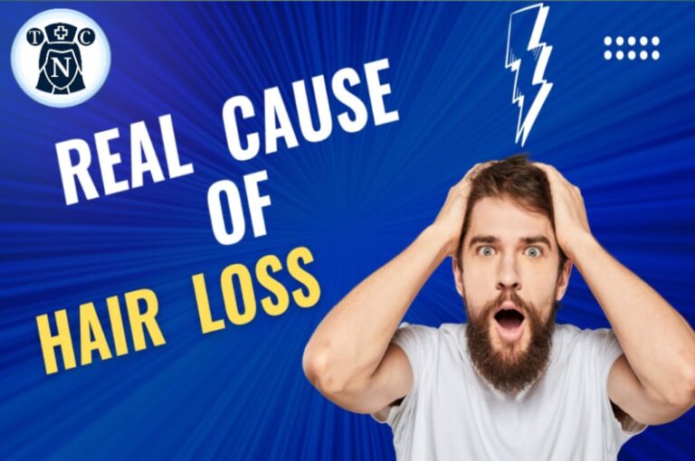 Real cause of hair loss